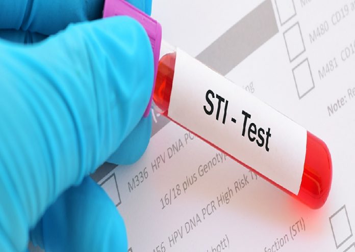 sti