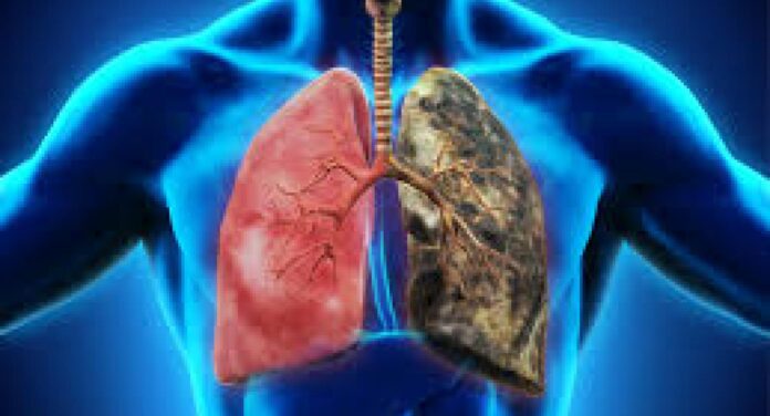 Lungs