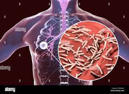 Health photo