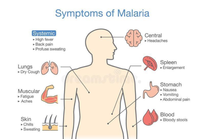 Malaria