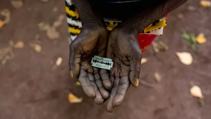 FGM